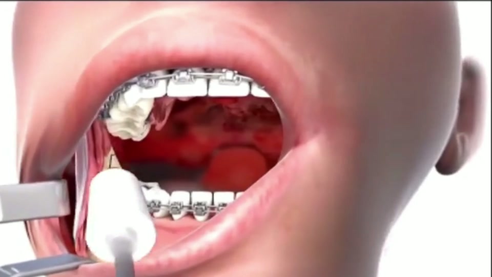 3D visualization of dental anatomy and a dental procedure